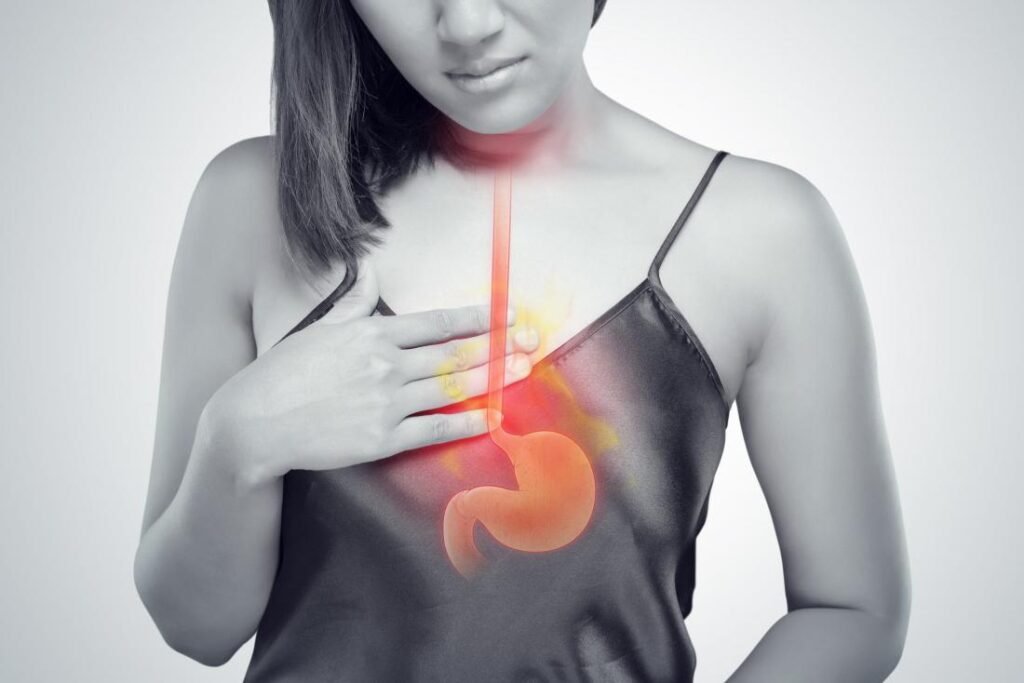 Reflux acide : symptômes, causes, diagnostic, traitement