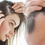 Qu&rsquo;est-ce que l&rsquo;alopécie?